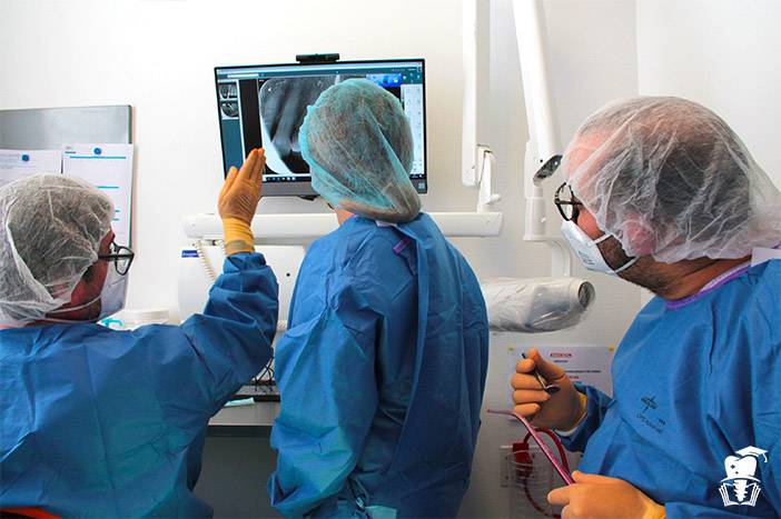 Formation en Implantologie, Chirurgie Greffe Osseuse et Sinus Lift, et prothèse sur implant par empreinte numérique